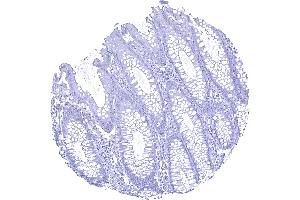 Colon descendes mucosa Calbindin 1 immunostaining is absent in all cells of the colon mucosa (CALB1 抗体  (AA 7-96))