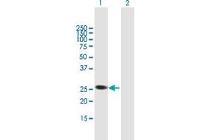 Western Blot analysis of AGPAT1 expression in transfected 293T cell line by AGPAT1 MaxPab polyclonal antibody. (AGPAT1 抗体  (AA 1-283))