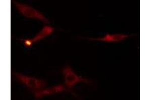 ABIN6275948 staining  HuvEc cells by IF/ICC. (FZD9 抗体  (C-Term))