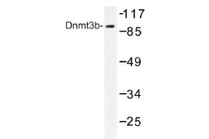 Image no. 1 for anti-DNA (Cytosine-5-)-Methyltransferase 3 beta (DNMT3B) antibody (ABIN317617) (DNMT3B 抗体)