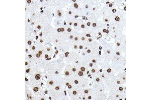 Immunohistochemistry of paraffin-embedded human liver using Histone H3 Rabbit pAb (ABIN3023242, ABIN3023243, ABIN3023244, ABIN1513010 and ABIN6219504) at dilution of 1:100 (40x lens).