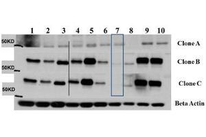 Western Blot of Mouse Anti-AKT3 antibody. (AKT3 抗体  (Internal Region))