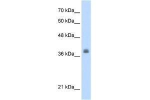 WB Suggested Anti-LDB1 Antibody Titration:  0. (LIM Domain Binding 1 Protein 抗体  (C-Term))