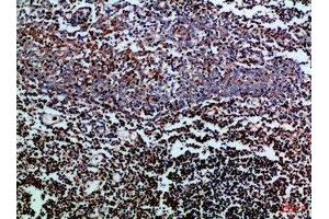 Immunohistochemical analysis of paraffin-embedded Human-tonsil, antibody was diluted at 1:100 (CD247 抗体  (AA 51-100))