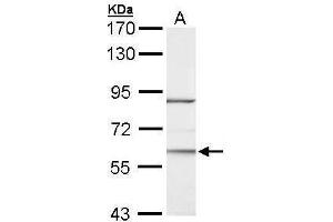 WB Image Sample (30 ug of whole cell lysate) A: Hela 7. (RORA 抗体)