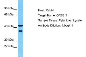 Western Blotting (WB) image for anti-Olfactory Receptor, Family 2, Subfamily B, Member 11 (OR2B11) (C-Term) antibody (ABIN2791721)