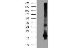 Western Blotting (WB) image for anti-Spermidine/Spermine N1-Acetyltransferase 2 (SAT2) antibody (ABIN1500807) (SAT2 抗体)