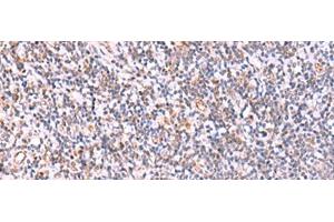 Immunohistochemistry of paraffin-embedded Human tonsil tissue using ITPKC Polyclonal Antibody at dilution of 1:40(x200) (ITPKC 抗体)