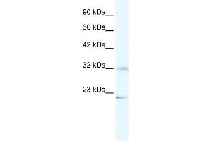 WB Suggested Anti-ZNF265 Antibody Titration:  1. (ZNF265 抗体  (N-Term))