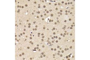 Immunohistochemistry (Paraffin-embedded Sections) (IHC (p)) image for anti-cAMP Responsive Element Binding Protein 1 (CREB1) antibody (ABIN3021674)