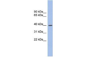 WB Suggested Anti-GLI4 Antibody Titration: 0. (GLI4 抗体  (N-Term))