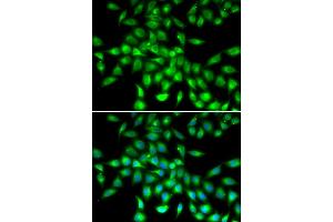 Immunofluorescence analysis of A549 cells using SERPINA10 antibody (ABIN6292722). (SERPINA10 抗体)