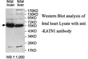 Image no. 1 for anti-Katanin P60 (ATPase Containing) Subunit A 1 (KATNA1) antibody (ABIN1577431) (KATNA1 抗体)