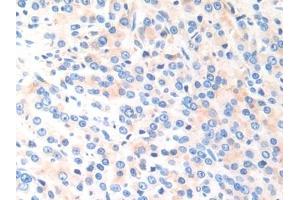 Immunohistochemistry (IHC) image for anti-Cathepsin K (CTSK) (AA 54-317) antibody (ABIN7441856)