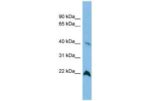TGDS antibody used at 1 ug/ml to detect target protein. (TGDS 抗体  (Middle Region))
