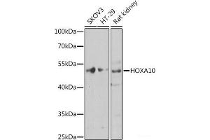 Western blot analysis of extracts of various cell lines using HOXA10 Polyclonal Antibody at dilution of 1:1000. (HOXA10 抗体)