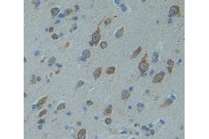 Used in DAB staining on fromalin fixed paraffin- embedded brain tissue (CNTNAP5 抗体  (AA 25-302))