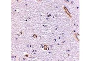 Immunohistochemistry (IHC) image for anti-Syntaphilin (SNPH) (Middle Region) antibody (ABIN1031114) (Syntaphilin 抗体  (Middle Region))