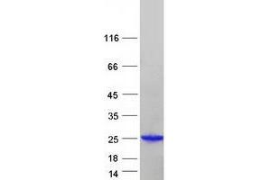 Western Blotting (WB) image for ADP-Ribosylation Factor-Like 2 (ARL2) protein (Myc-DYKDDDDK Tag) (ABIN2714907)