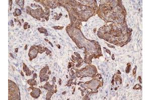 Immunohistochemistry (IHC) image for anti-Keratin 17 (KRT17) (C-Term) antibody (ABIN870563) (KRT17 抗体  (C-Term))