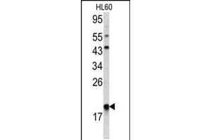 Western blot analysis of ARPC3 antibody in HL60 cell line lysates(35ug/lane) (ARPC3 抗体  (C-Term))