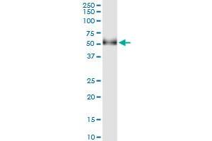 Immunoprecipitation of GAK transfected lysate using anti-GAK MaxPab rabbit polyclonal antibody and Protein A Magnetic Bead , and immunoblotted with GAK purified MaxPab mouse polyclonal antibody (B01P) . (GAK 抗体  (AA 1-416))