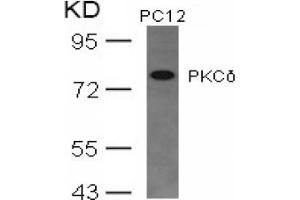 Image no. 3 for anti-Protein Kinase C, delta (PKCd) (AA 643-647) antibody (ABIN197564) (PKC delta 抗体  (AA 643-647))