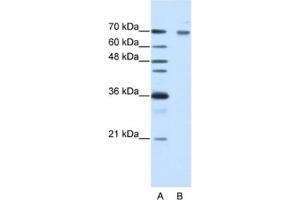 Western Blotting (WB) image for anti-Frizzled Family Receptor 7 (FZD7) antibody (ABIN2462375) (FZD7 抗体)