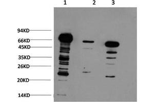 Western Blotting (WB) image for anti-Ubiquitin (Ubiquitin) antibody (ABIN5958540) (Ubiquitin 抗体)