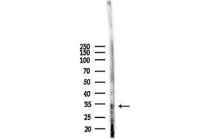 anti-Chloride Intracellular Channel 3 (CLIC3) (N-Term) antibody