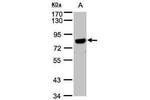 WB Image Sample(30 μg of whole cell lysate) A:Hep G2, 7. (APP 抗体  (C-Term))