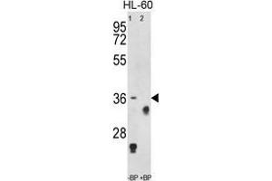Western blot analysis of anti-TNFRSF14 Antibody (Center) Pab pre-incubated without(lane 1) and with (lane 2) blocking peptide in HL-60 cell line lysate. (HVEM 抗体  (Middle Region))