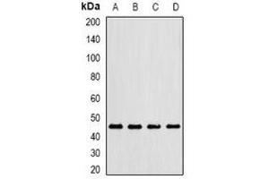 Western blot analysis of Gastric Lipase expression in MCF7 (A), mouse lung (B), mouse liver (C), rat kidney (D) whole cell lysates. (LIPF 抗体)