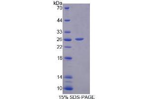 SDS-PAGE analysis of Rat IL17D Protein. (IL17D 蛋白)