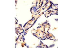 Antibody staining CAD in human placenta tissue sections by Immunohistochemistry (IHC-P - paraformaldehyde-fixed, paraffin-embedded sections). (CAD 抗体  (AA 780-809))