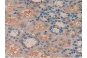 IHC-P analysis of Human Kidney Tissue, with DAB staining. (SYK 抗体  (AA 374-635))