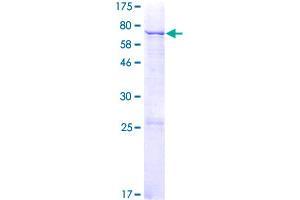 MGAT5B Protein (AA 1-394) (GST tag)