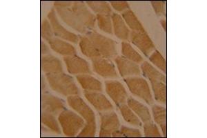Immunohistochemistry analysis in formalin fixed and paraffin embedded human skeletal muscle reacted with LMOD2 Antibody (N-term) followed which was peroxidase conjugated to the secondary antibody and followed by DAB staining. (Leiomodin 2 抗体  (N-Term))