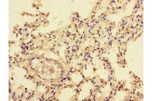 Immunohistochemistry (IHC) image for anti-Nuclear Factor I/C (CCAAT-Binding Transcription Factor) (NFIC) (AA 201-428) antibody (ABIN7161758)