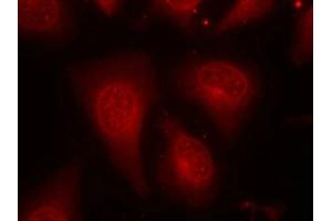 Immunofluorescence staining of methanol-fixed Hela cells using HDAC8(Phospho-Ser39) Antibody. (HDAC8 抗体  (pSer39))