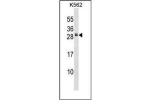Western blot analysis of HBEGF Antibody (Center) in K562 cell line lysates (35ug/lane). (HBEGF 抗体  (Middle Region))