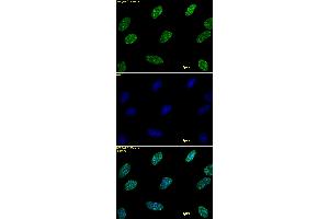 Histone H3 dimethyl Lys9 antibody tested by immunofluorescence. (Histone 3 抗体  (2meLys9))