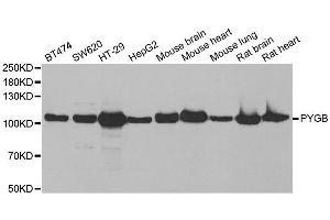 Western blot analysis of extracts of various cell lines, using PYGB antibody. (PYGB 抗体)
