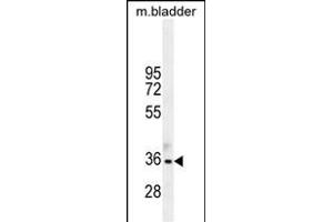 TGIF1 Antibody (Center ) (ABIN655999 and ABIN2845378) western blot analysis in mouse bladder tissue lysates (35 μg/lane). (TGIF1 抗体  (AA 208-237))