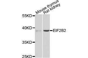 Western blot analysis of extracts of various cell lines, using EIF2B2 antibody (ABIN5975464) at 1/1000 dilution. (EIF2B2 抗体)