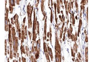 ABIN6266853 at 1/100 staining human Heart muscle tissue sections by IHC-P. (Transglutaminase 2 抗体  (N-Term))
