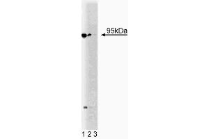 Western blot analysis of Neurotensin Receptor 3 on a PFSK-1 cell lysate (Human neuroectodermal tumor line, ATCC CRL-2060). (Sortilin 1 抗体  (AA 300-422))