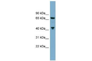 WB Suggested Anti-GLS Antibody Titration: 0. (Glutaminase 抗体  (C-Term))