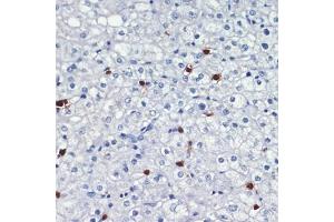 Immunohistochemistry (IHC) image for anti-S100 Calcium Binding Protein A8 (S100A8) (AA 1-93) antibody (ABIN7270129)