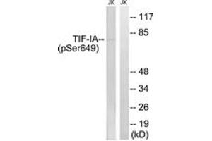Western blot analysis of extracts from Jurkat cells treated with starved 24h, using TIF-IA (Phospho-Ser649) Antibody. (RRN3 抗体  (pSer649))